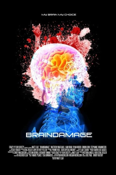 Braindamage